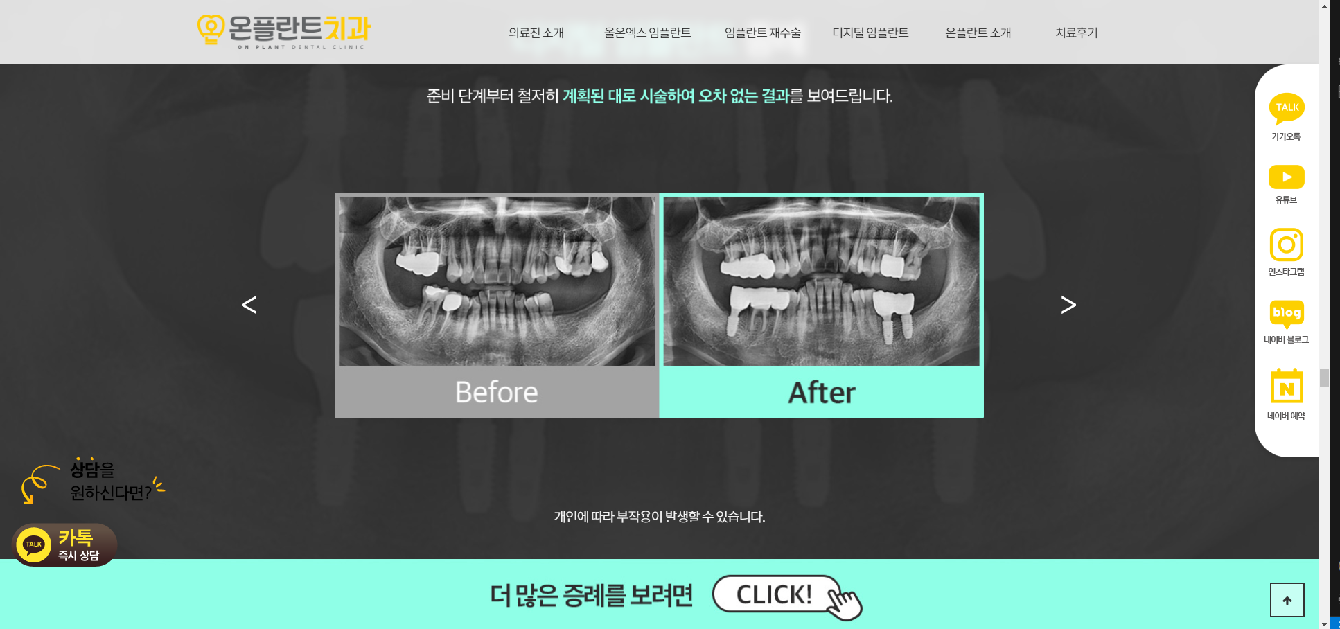 온플란트치과_01